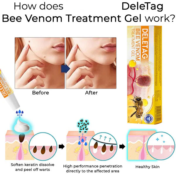 DeleTag Bee Venom Treatment Gel