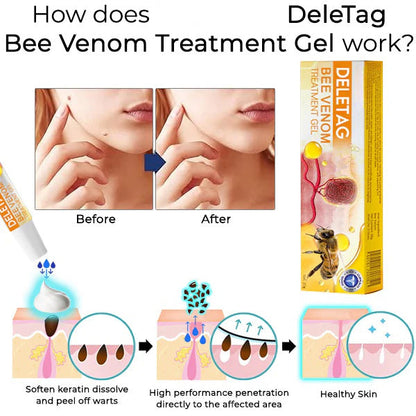 DeleTag Bee Venom Treatment Gel