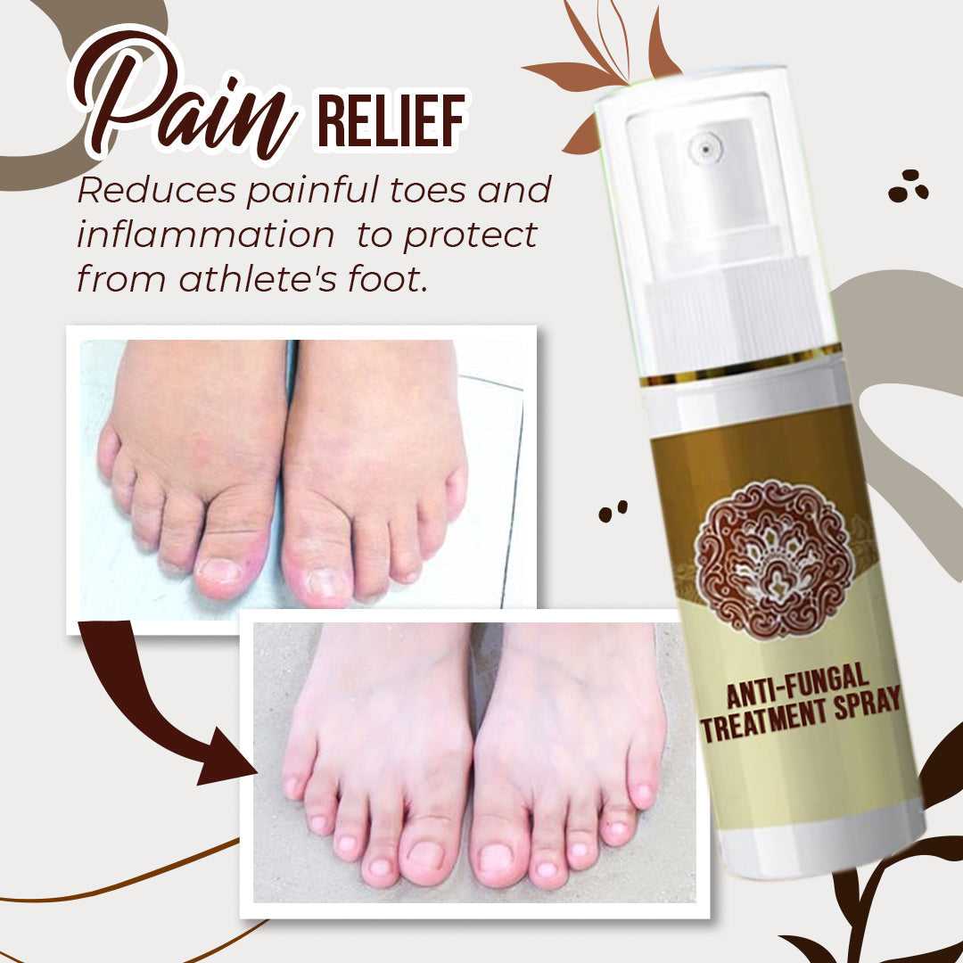 Premium Anti-Fungal Treatment Spray